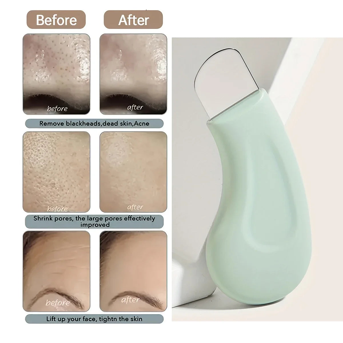 ClearPore Nose and Face Tool